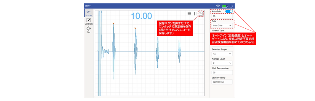 タブレットにリアルタイムでエコーを表示