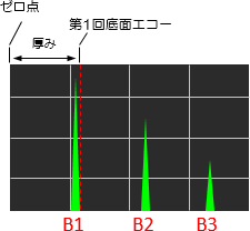 波形（エコー）