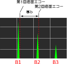 波形（エコー）