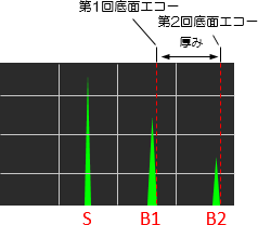 波形（エコー）