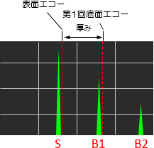 波形（エコー）